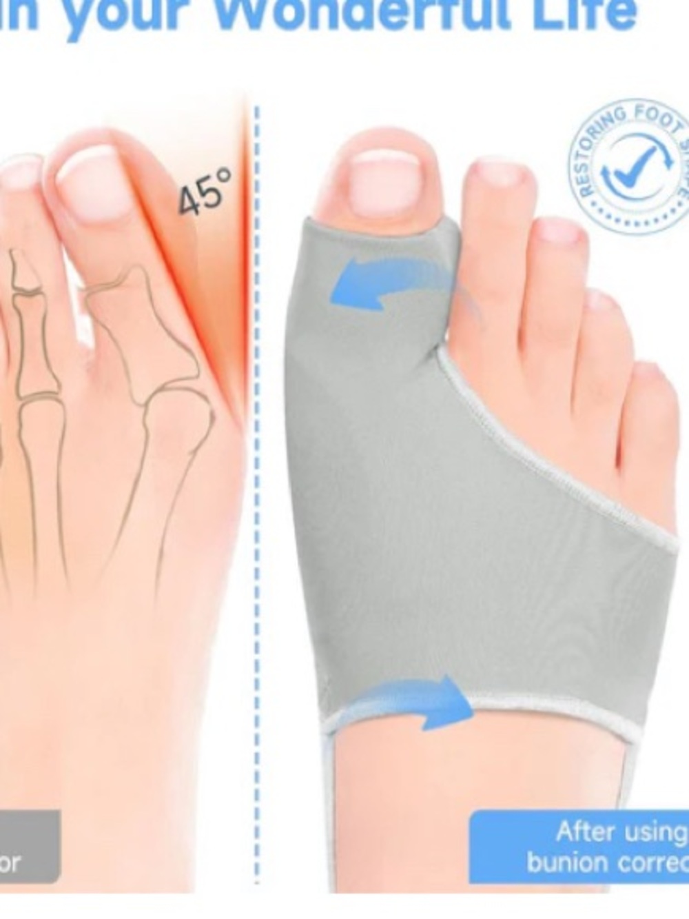 A pair Bunion Corrector Sleeve Toe Alignment Support soft medical grade fabric